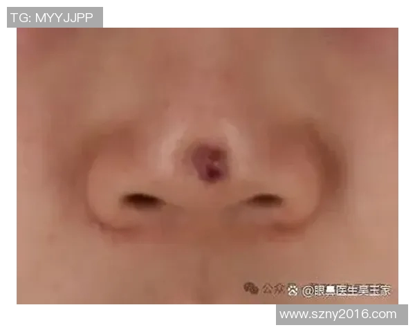 姚明华隆鼻背后的故事与影响探讨及公众反应分析